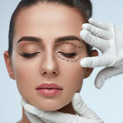 blepharoplastie