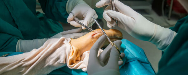 Chirurgiens de pied